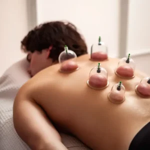 10-Piece Hijama Cupping